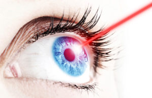 laser eye surgery claims