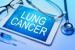 asbestos lung cancer claims on the increase